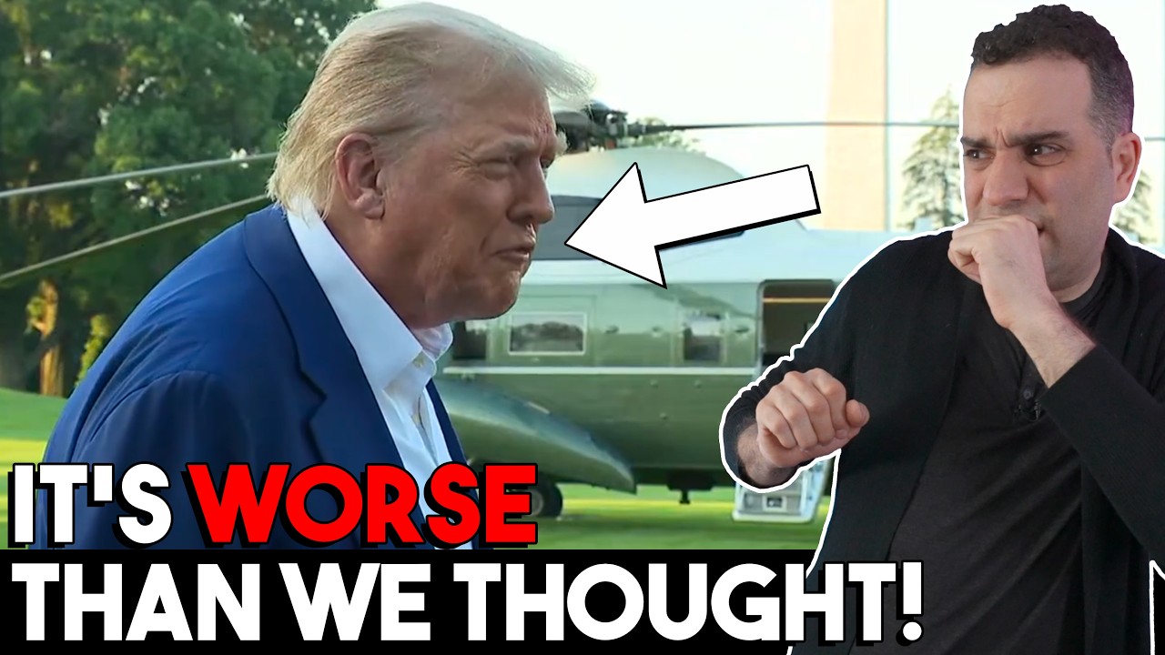 Why Trump REALLY Snapped! Body Language Analyst Reacts.